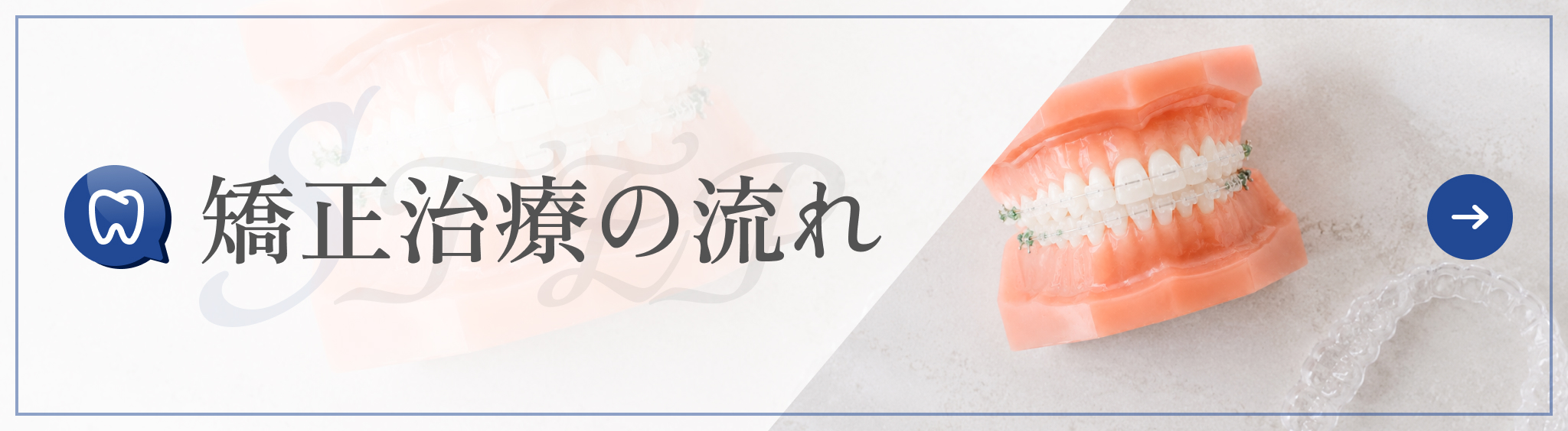 矯正治療の流れ